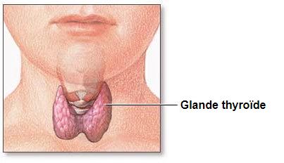 Is Thyroid troubling you?