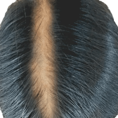files/reduce_hair_fall.webp